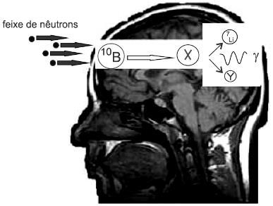 a) desintegra-se, emitindo partículas de carga positiva. b) estabiliza-se a partir de trinta e dois dias. c) possui meia-vida de oito dias. d) alcança a massa de 25 gramas em três meias vidas.