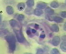 a b Figura 3. Sarcocystis cruzi.