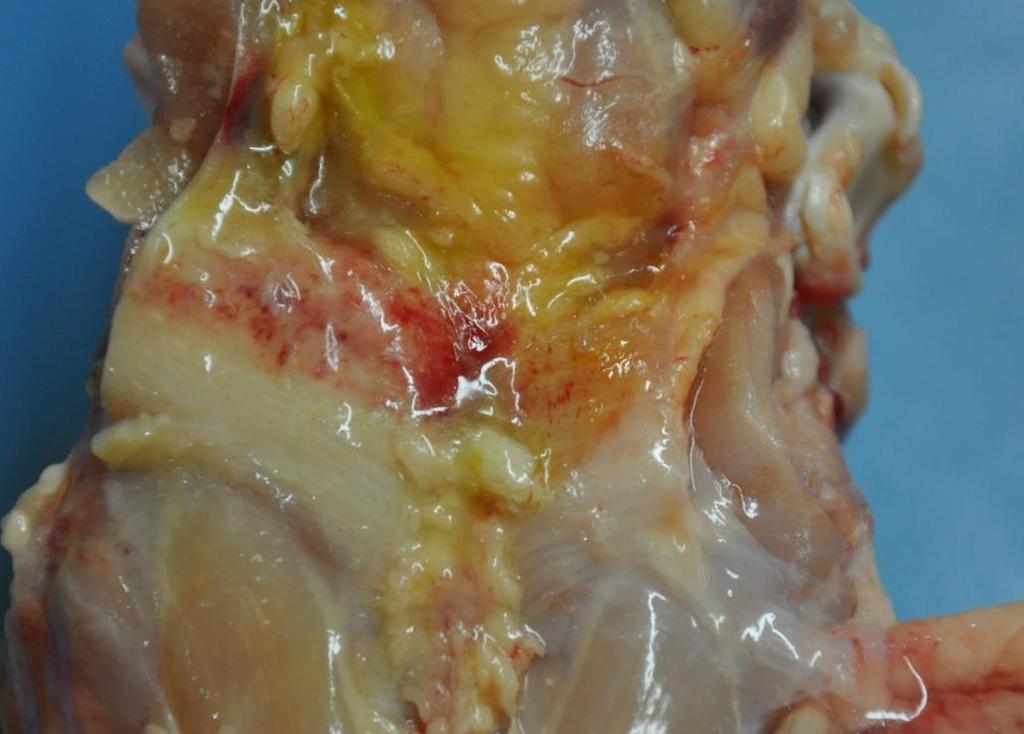 28 Figura 3 - Músculo ALD de carcaça de frango acometido com Miopatia Dorsal Cranial (MDC). Fonte: o próprio autor. 5.