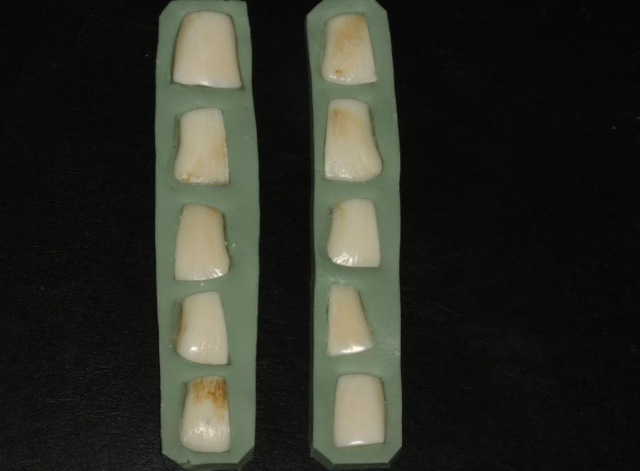 15 Figura 1: Dentes bovinos fixados em silicone de condensação. Fonte: Acervo de Imagens UNISC. Figura 2: Dentes bovinos fixados em silicone de condensação.