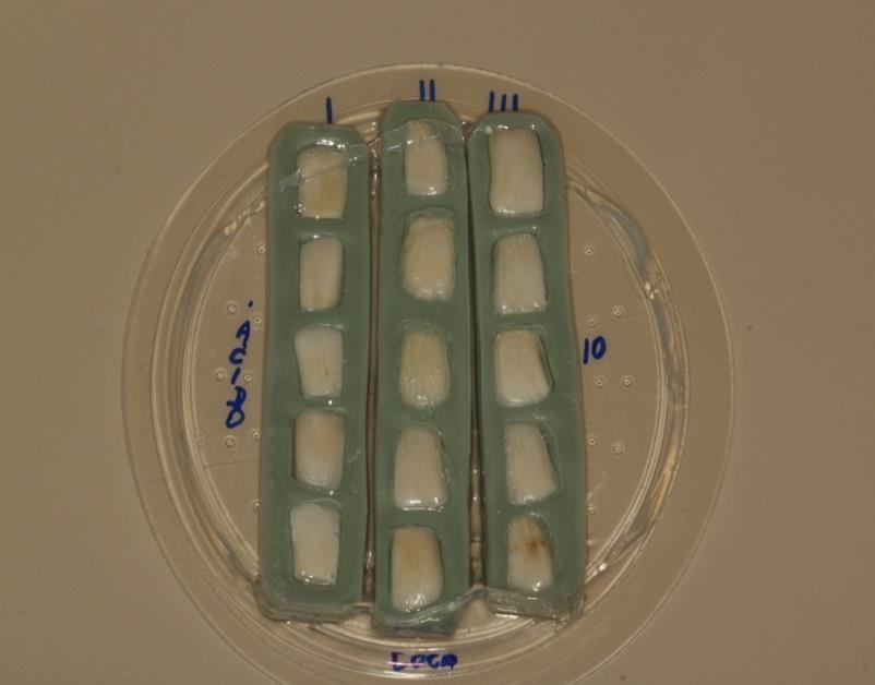 Após o tratamento dos cinco grupos por 14 dias, a análise da superfície dos dentes bovinos foi realizada no Laboratório de Metalúrgica Física, do curso de Engenharia de Produção da UNISC pelo técnico