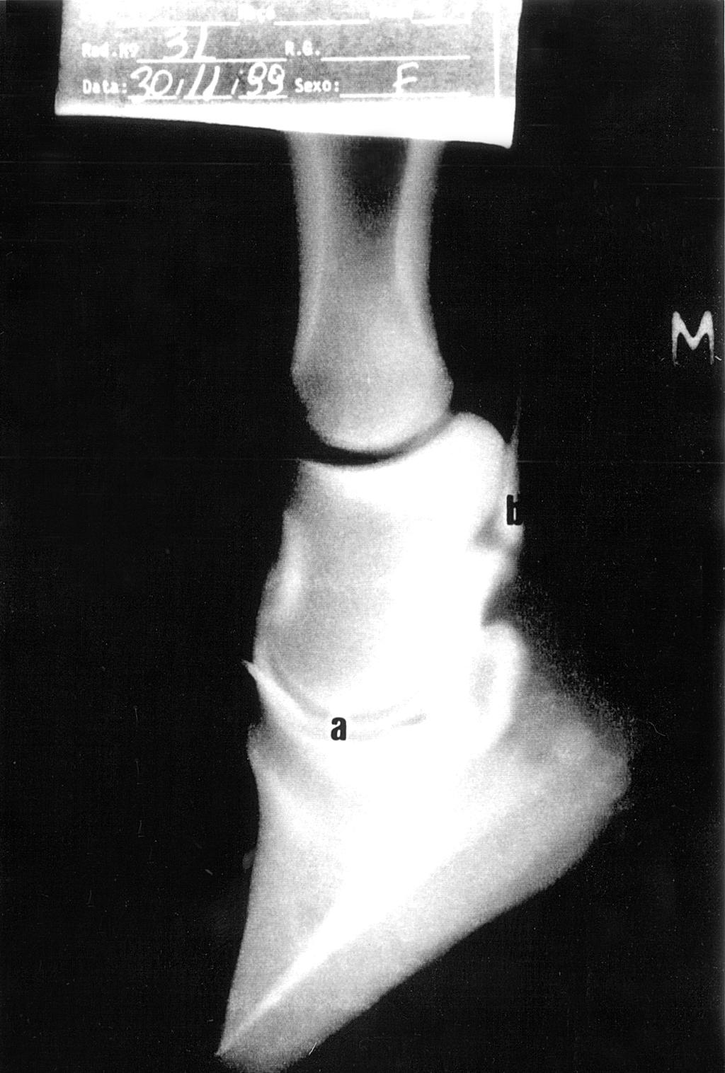 dia de idade demonstrando a articulação interfalangeana distal (a), bolsa do osso navicular (b), tendão do flexor profundo do dedo (c), falange média (d), falange distal (e), extremidade distal da