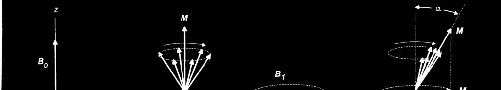 Mviment de precessã e magnetizaçã M ω = γb ω = 2πν [ N ( ) ( )] 0 = µ mag N a) Um mment magnétic (spin nuclear), rientad parcialmente cm relaçã a B, executa um mviment de precessã em trn d camp