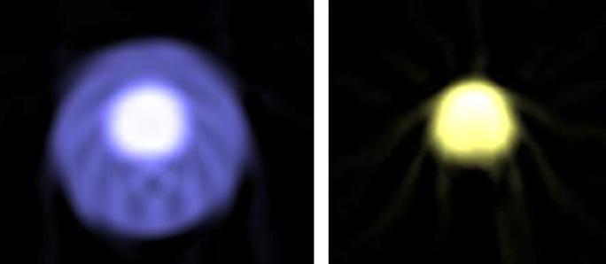 transmission microtomography can be used to recover r iu (x,y).