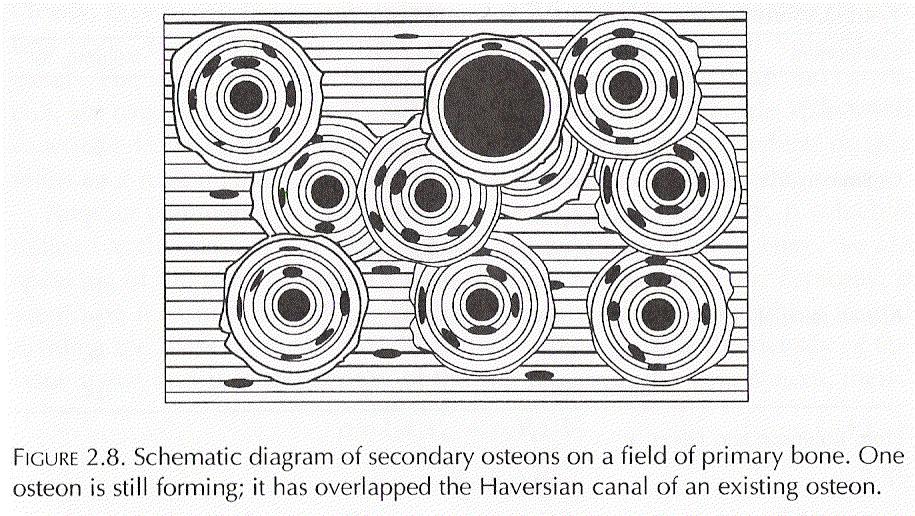 remodelação óssea no osso cortical num local onde não existem osteons, a criação dum osteon aumenta a porosidade, devido à formação do canal de