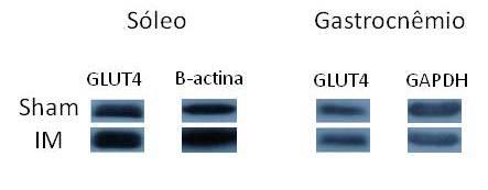2,0 1,8 1,6 A GLUT4/β-actina (unidades arbitrárias) 1,4 1,2 1,0 0,8 0,6 0,4 0,2 0,0 Sham IM 1,8 1,6 1,4 B GLUT4/GAPDH (unidades arbitrárias) 1,2 1,0 0,8 0,6 0,4 0,2 0,0 Sham IM Figura 2.
