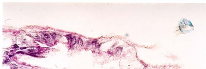 glândula salivar D1 de Rhodnius robustus