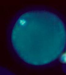 63 ovócitos corados foram examinados em microscópio invertido equipado com luz