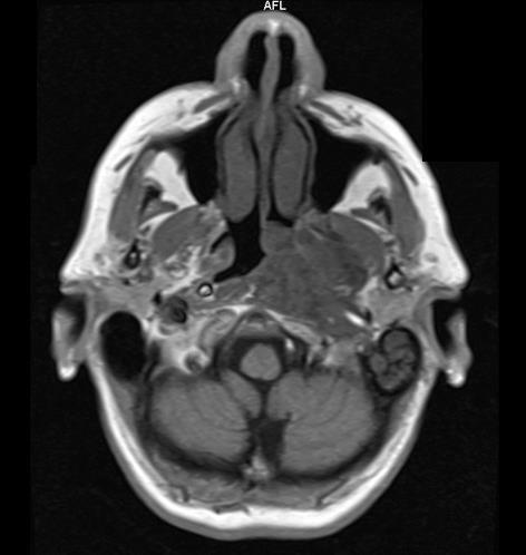 Corte Axial