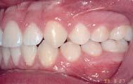dentário (M,