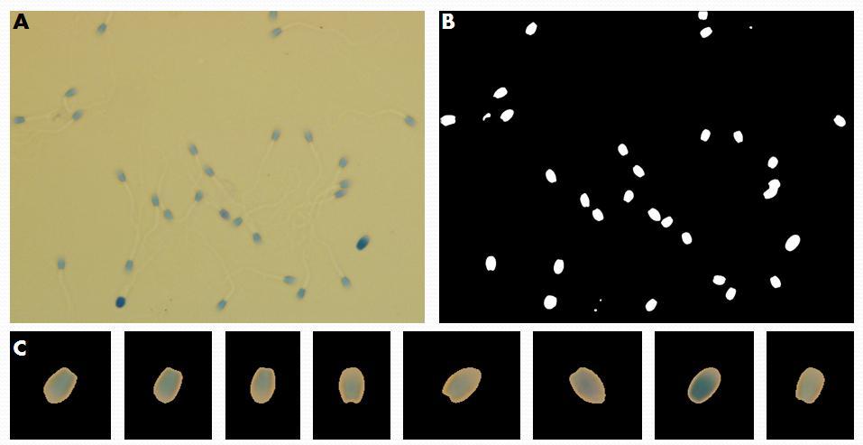 11 Figura 2: Fotomicrografias de (A) espermatozoides da cauda do epidídimo de gato doméstico corados com azul de toluidina (X1000).