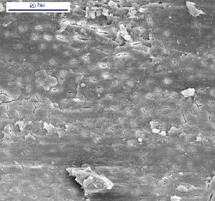 17 A formação do smear layer ocorre durante o preparo biomecânico, pela ação dos instrumentos que atuam cortando a dentina radicular.