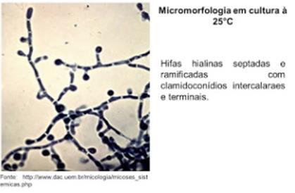 Morfologia dos fungos Fungos Filamentosos -
