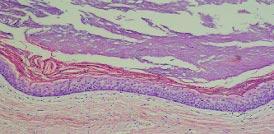 A cápsula conjuntiva bem vascularizada, fina e friável, em geral, livre de inflamação (BARNNON; COLONEL, 1976, EL-HAJJ; ANNEROTH, 1996,