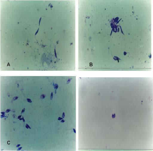 Figura 31 - Formas promastigotas de L. (L.