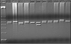 Material e Métodos 50 Figura 8 Foto do gel de agarose com a genotipagem do polimorfismo VNTR do SLC6A3 4.2.2.1.