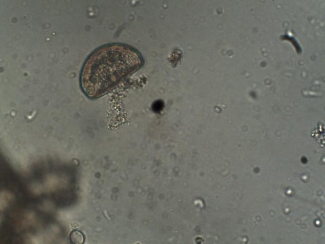 58 Figura 13: Arcella com aumento de 400x Figura 14: Epistylis com aumento de 200x Os microorganismos encontrados: Rotatória, Trachelphyllum e Arcella (figuras 11