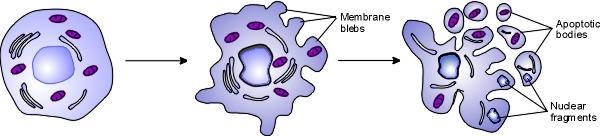 B- Macrófago em apoptose. Notar a retração do volume celular e a presença de corpos apoptóticos.