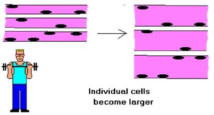 4 Adaptação Celular HIPERTROFIA Aumento do tamanho das células e com esta alteração aumento do tamanho do órgão.