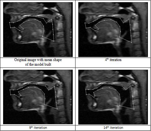 Segmentação Análise do tracto vocal durante a fala partir de imagens de ressonância magnética: modelos ativos de forma Imagem original + modelo médio Segmentação intermédia I