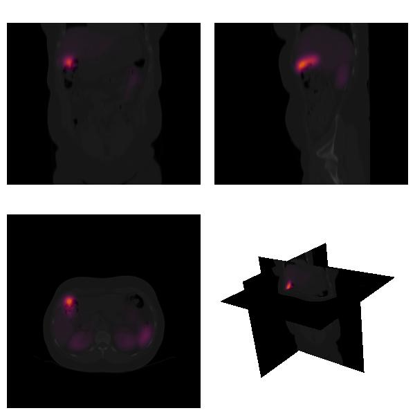 Visão 3D Reconstrução 3D de órgãos a partir de imagens de diferentes modalidades: alinhamento,