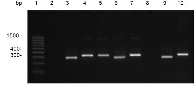 4.3 Caracterização molecular das cepas de T. cruzi Após a amplificação do gene mini-exon dos cinco isolados de T. cruzi obtidos de T. b.