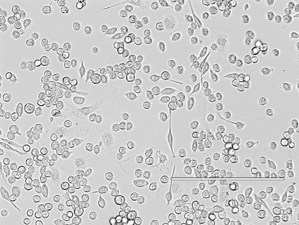 13 A B 200 µm 200 µm FIGURA 2: Aspecto morfológico da cultura de MSC plaqueada em alta densidade (8x10 5 células/cm 2 ) após 1 (A) e 2 (B) semanas do plaqueamento inicial.
