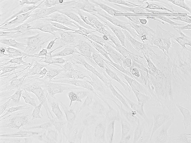 As setas em A indicam células com prolongamentos citoplasmáticos e em evolução para assumir o aspecto fibroblastóide já melhor observado em B.
