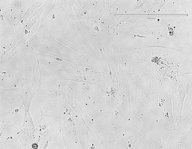 15 A B 200 µm 200 µm FIGURA 5: Fibroblastos cardíacos (A) e MSC (B) em terceira passagem com tripsina e previamente à indução de diferenciação. (Aumento de 200 vezes) 3.5.1 Adipogênese As culturas de MSC utilizadas para a indução da adipogênese, no dia 0 referente ao início do protocolo de diferenciação, apresentaram-se confluentes e com aspecto fibroblastóide.