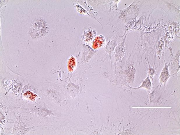 A coloração em vermelho marca células contendo vacúolos lipídicos citoplasmáticos (setas). Não foram observados vacúolos intracelulares na cultura de FC (Aumento de 400 vezes). 3.5.