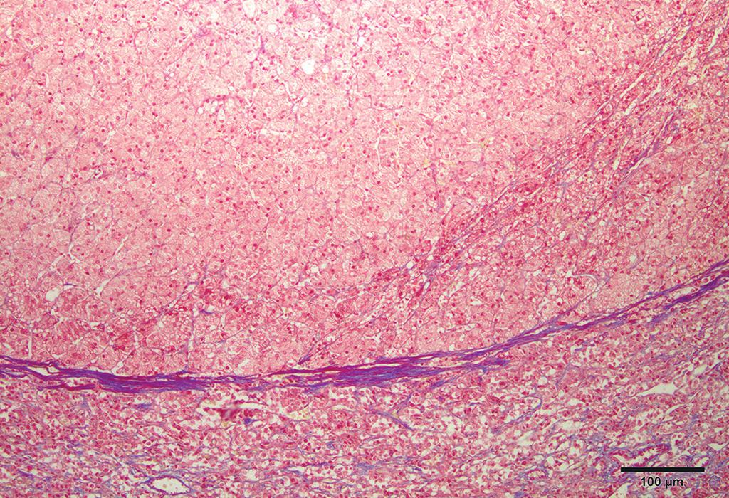 friável. Pesq. Vet. Bras. ():9-, janeiro 9 Fig.. Hiperplasia difusa da cortical.