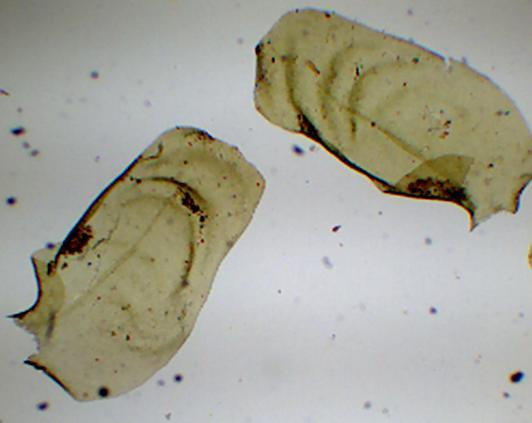 A B C D Figura 30: Neckeropsis undulata. A: Filídio. B: Ápice do filídio. C: Células da margem e D: Visão geral da cápsula (Soares et al. 90).