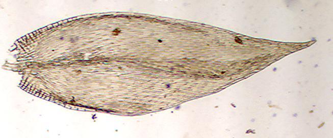 vezes levemente côncavo; margem inteira abaixo, serrulada a serreada próximo ao ápice, plana; costa terminando um pouco acima da região mediana; célula linear, 8-14:1, menor no