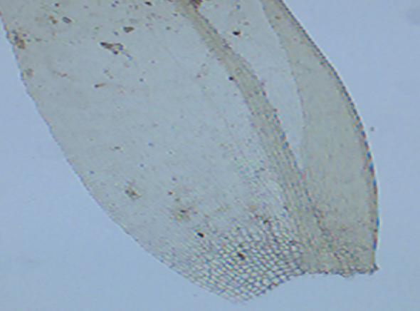 A B Figura 54: Eulacophyllum cultelliforme. A: Filídio. B: Margem e células do filídio (Dias-Neto 471). Escala: A = 100µm e B = 10µm. 18.