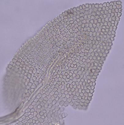 ramificação, filamentoso, uniseriado, não ramificado, compost por 3-9 células, quadrada, pluripapilosa,