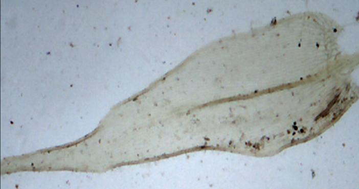 A B C D Figura 5: Brachythecium ruderale. A: Fílidio da ramificação. B: Ápice aristado do filídio. C: Base do filídio da ramificação.
