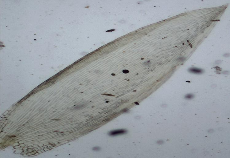 A B C D Figura 8: Entodon beyrichii. A: Filídio. B: Ápice do filídio. C: Base e células alares do filídio.