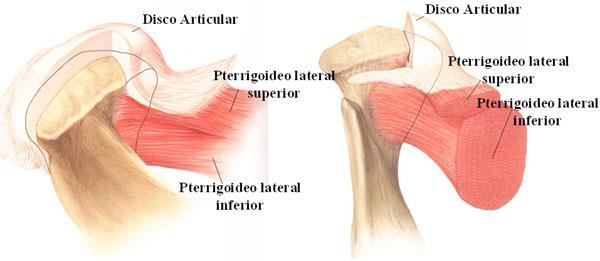 Pterigóideo Lateral