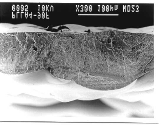 A Figura 8c mostra a micrografia referente à superfície de fratura da membrana de PLLA antes de ser iniciada a degradação, enquanto a Figura 8d mostra a micrografia da superfície de fratura do PLLA
