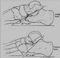 RX Axial (Harris View)