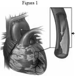 06 - (UDESC SC) A figura abaixo representa o esquema de um coração humano, no qual estão indicadas algumas de suas estruturas.