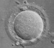 MORFOLOGIA OOCITÁRIA ALTERAÇÕES EXTRACITOPLASMÁTICAS ZP ESPESSA DEBRIS NO EP EP AUMENTADO CLASSIFICAÇÃO EMBRIONÁRIA A transferência de embriões de melhor prognóstico e de elevado potencial para