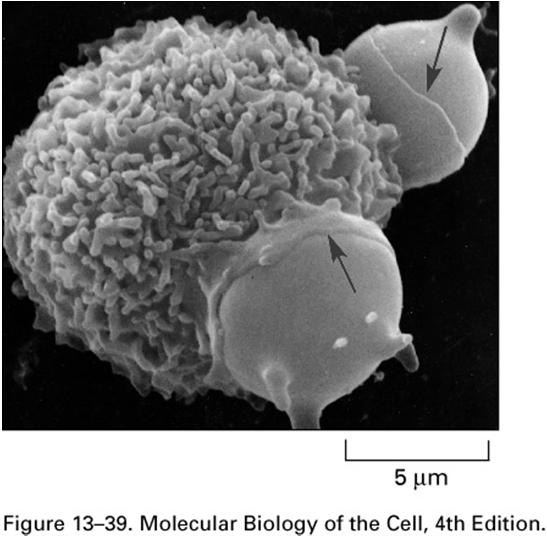 Transporte da membrana plasmática para o interior da célula Endocitose Células captam macromoléculas, substâncias particuladas ou outras células material ingerido é progressivamente englobado por uma