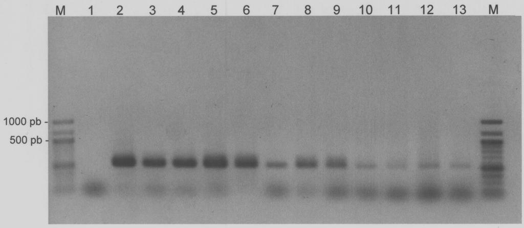 198 Coelho et al. Figura 1 - Eletroforese do fragmento do gene meca (513 pb), de cepas de taphylococcus spp isoladas de amostras humanas e animais, em gel de agarose a 1%. Legenda: M.