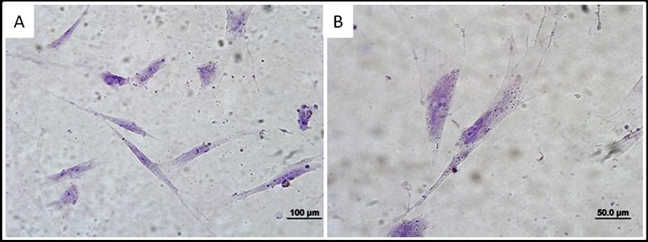 Figura 6- Fotomicrografia de coloração de azul de toluidina de células-tronco de membrana amniótica 40d (Fonte: WINCK, C.P, 2012) Legenda: A) Aumento 20x.