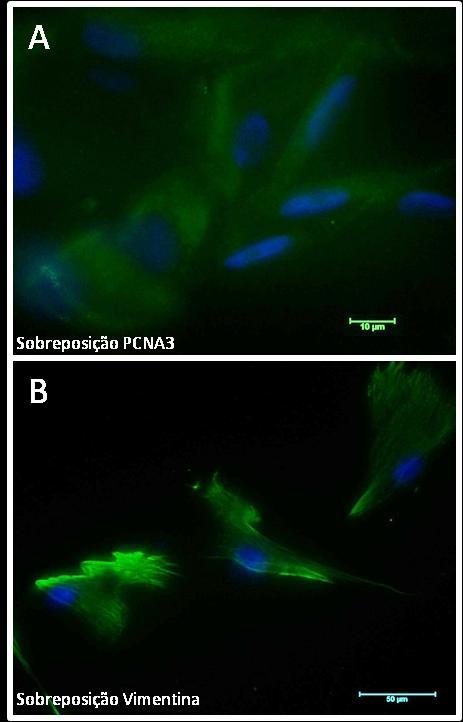 43 Figura 10 - Análise do perfil de expressão de PCNA3 e vimentina das células-tronco de membrana amniótica 40d (Fonte: