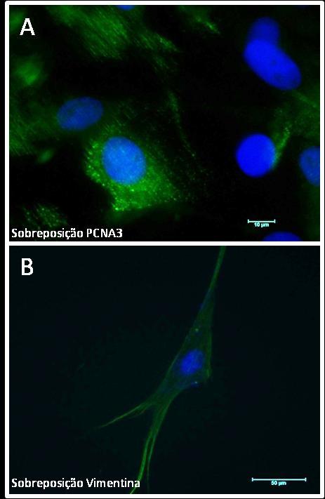 46 Figura 13 - Análise do perfil de expressão de PCNA3 e vimentina das células-tronco de membrana amniótica 50d (Fonte: WINCK, C.P, 2012) Legenda: A) Marcação positiva para PCNA3. Aumento 1000x.