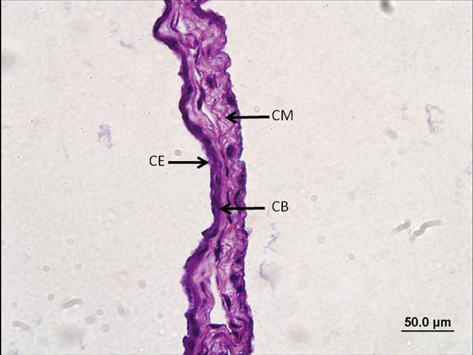 55 Figura 26 Fotomicrografia da membrana amniótica de 50 dias após coloração com HE (Fonte: WINCK, C.