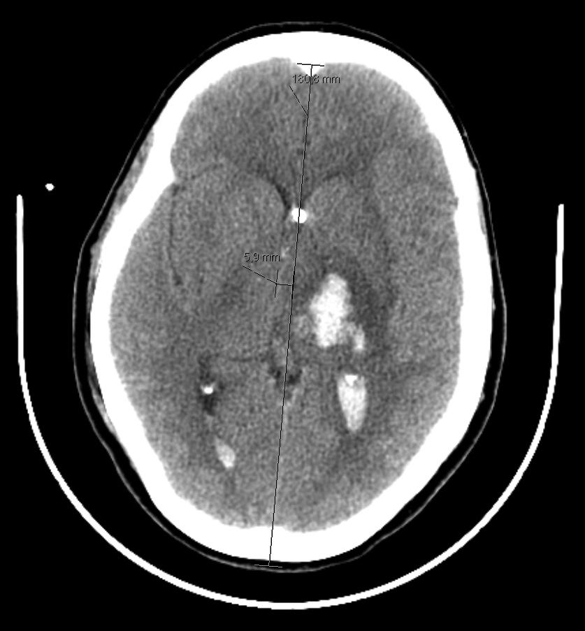 Série de imagens de exames complementares de diagnóstico referentes a 4 casos de doentes da nossa amostra populacional: Caso 1 (nr.