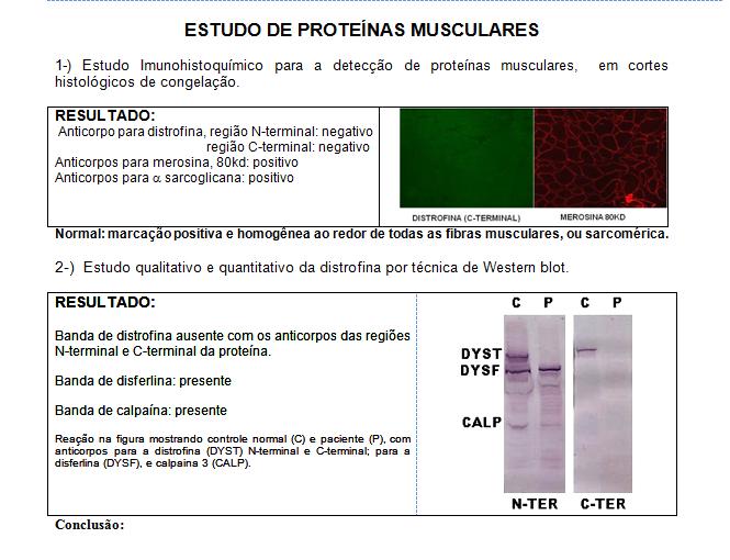 Avaliação da distrofina em